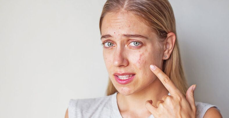 Skin problems with smoking cessation